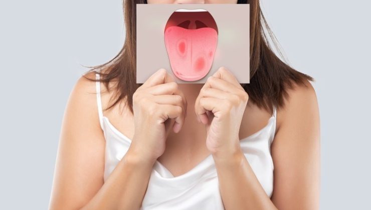 Diliniz aynada böyle görünüyorsa dikkat! Dildeki renk değişimi hangi hastalıkların habercisi?